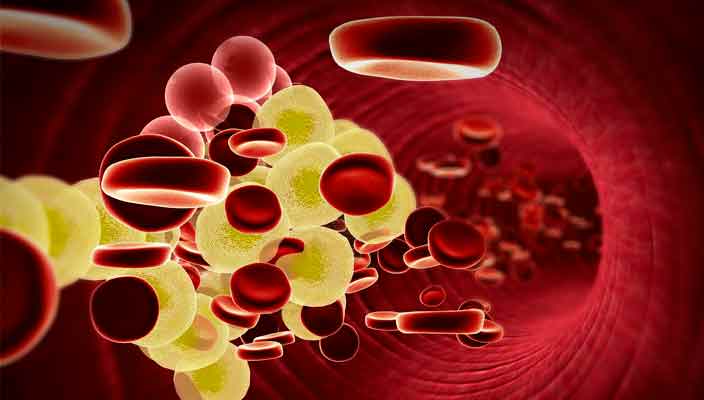 Холестерин – притаившийся враг кровеносных сосудов
