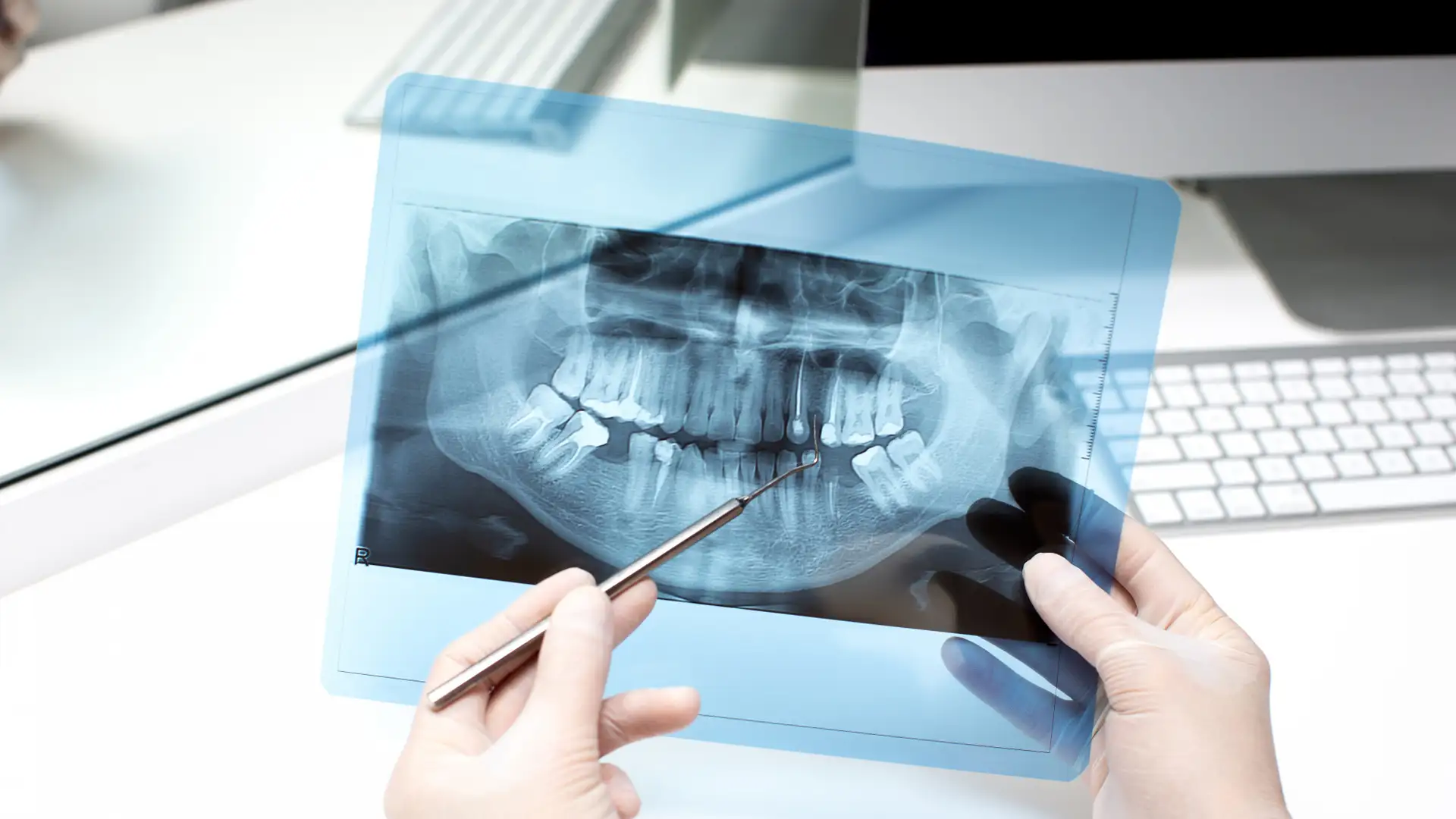 Професійне видалення зубів на Відрадному в Києві